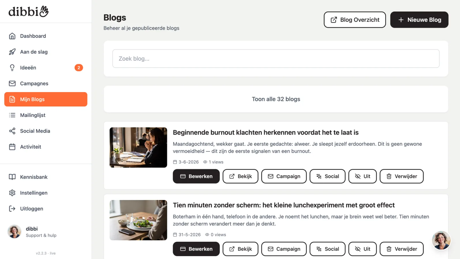 Blogoverzicht in dibbi met de knop Social bij elke blog